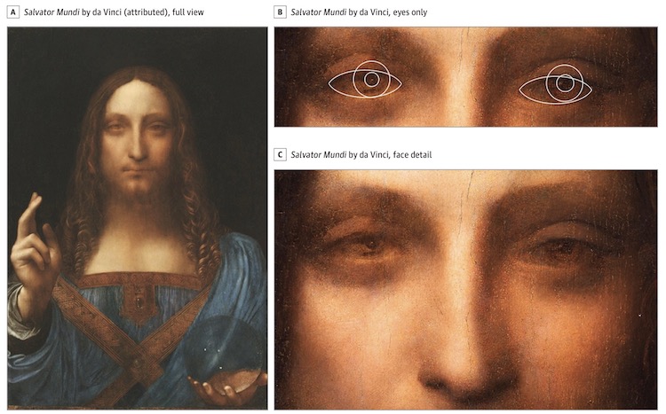 A Vision Disorder May Have Made Leonardo da Vinci A Great Artist – RankRed