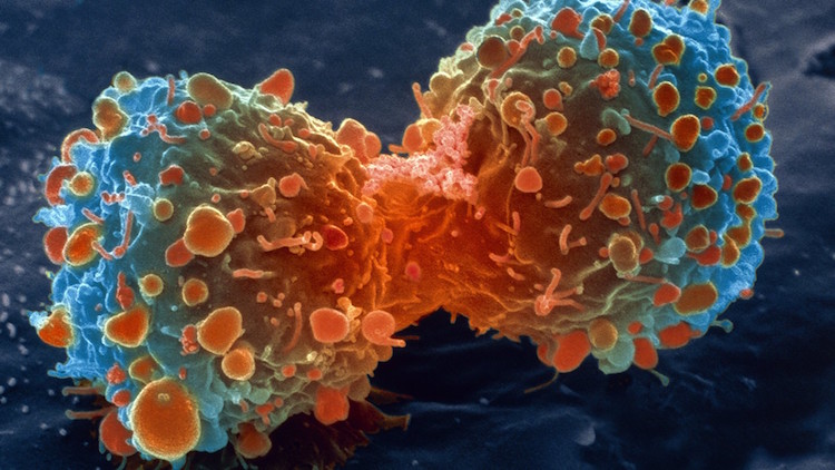 cancer cell